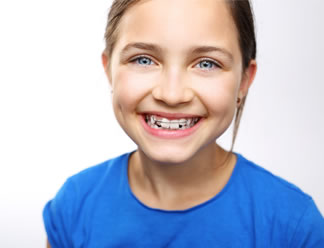 orthodontic retention